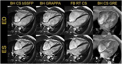 Building a comprehensive cardiovascular magnetic resonance exam on a commercial 0.55 T system: A pictorial essay on potential applications